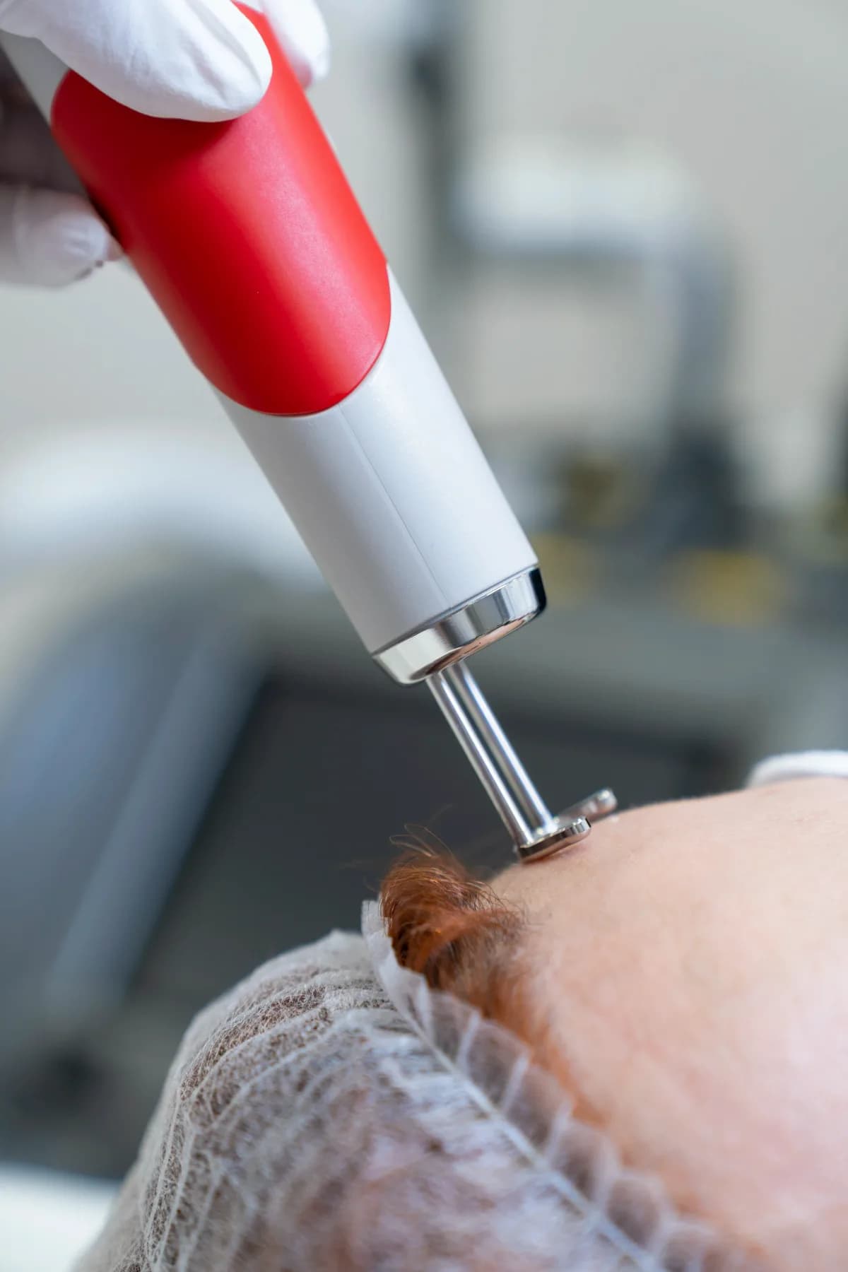 Dr. Mehmet Karakuyu Picolazer uygulaması